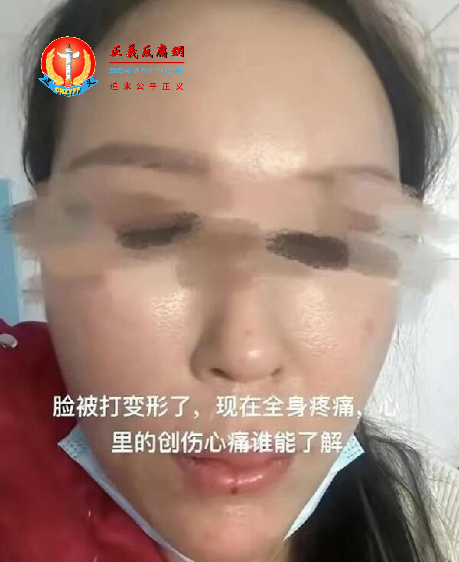 3月24日，咸阳一女子在美食城被多名男子追赶殴打致脸部变形.png